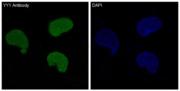 YY1 Rabbit mAb ABZ4975