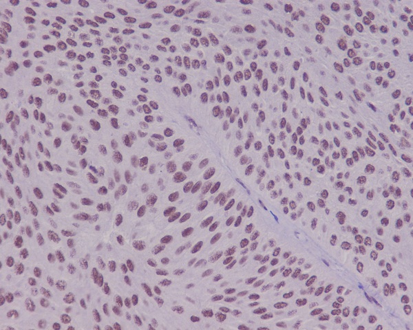 YY1 Rabbit mAb ABZ4975