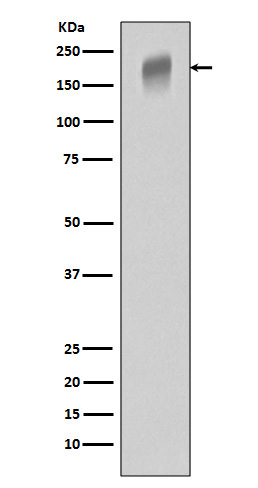 VEGF Receptor 1 Rabbit mAb ABZ4976