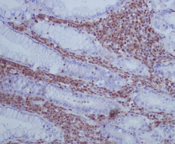 GAP43 Rabbit mAb ABZ4977