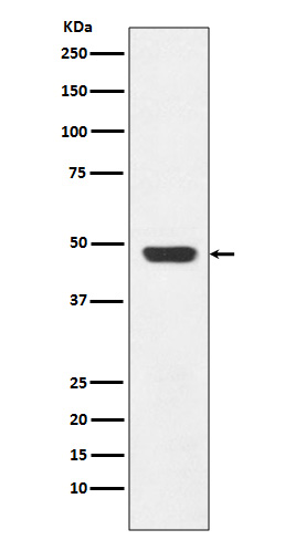 GAP43 Rabbit mAb ABZ4977