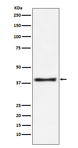Aspartate Aminotransferase Rabbit mAb ABZ4978