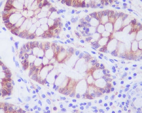 Stathmin 1 Rabbit mAb ABZ4979