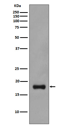 Stathmin 1 Rabbit mAb ABZ4979