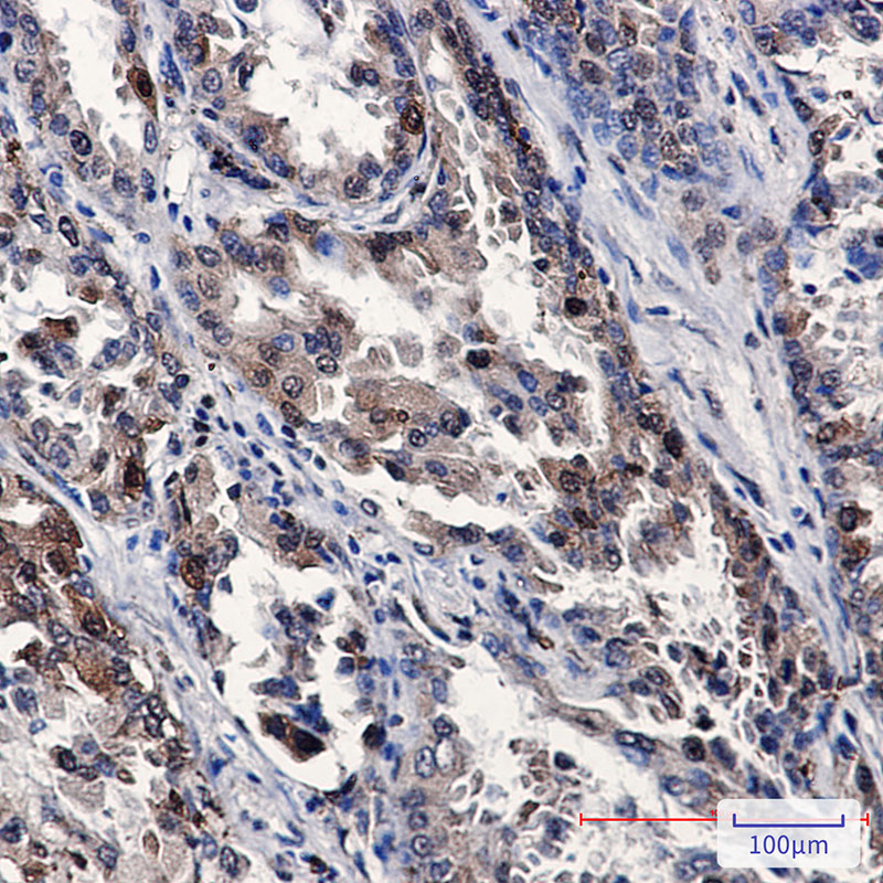 Stathmin 1 Rabbit mAb ABZ4980