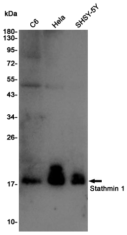 Stathmin 1 Rabbit mAb ABZ4980
