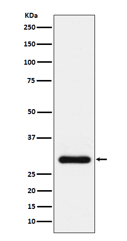 BNP Rabbit mAb ABZ4981