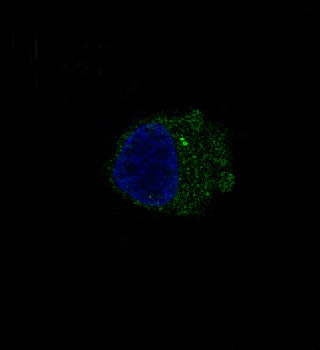 S100 beta Rabbit mAb ABZ4982