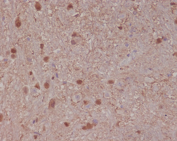 S100 beta Rabbit mAb ABZ4982