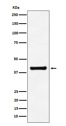 Aldolase Rabbit mAb ABZ4983