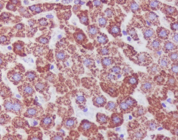 Catalase Rabbit mAb ABZ4984