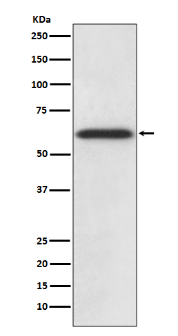 Catalase Rabbit mAb ABZ4984
