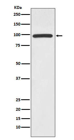 HMGCR Rabbit mAb ABZ4985