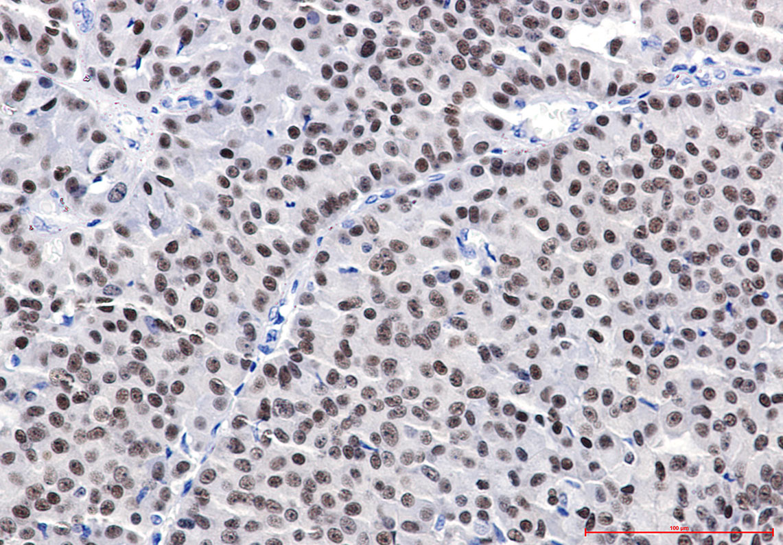 ER alpha Rabbit mAb ABZ4986