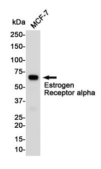 ER alpha Rabbit mAb ABZ4986