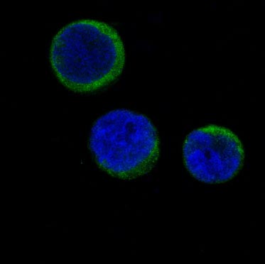 Ferritin Rabbit mAb ABZ4987