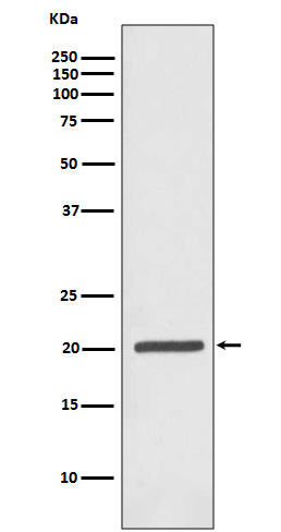Ferritin Rabbit mAb ABZ4987