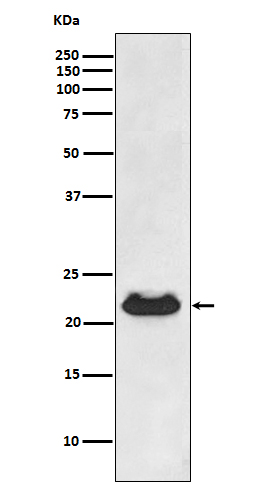 Alpha B Crystallin Rabbit mAb ABZ4988