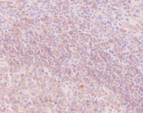 Human IgM Rabbit mAb ABZ4989