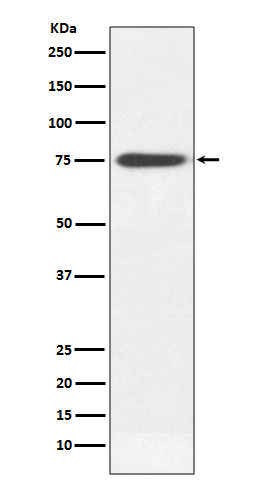 Human IgM Rabbit mAb ABZ4989