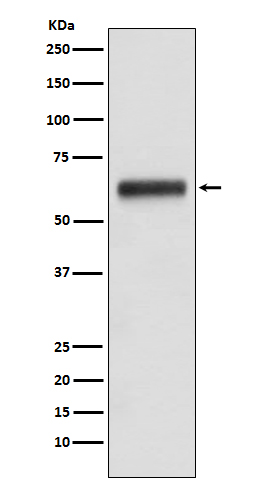 Human IgG3 Rabbit mAb ABZ4990
