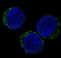 CD8 alpha Rabbit mAb ABZ4991
