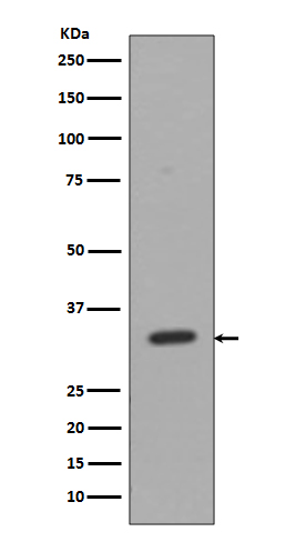 CD8 alpha Rabbit mAb ABZ4991