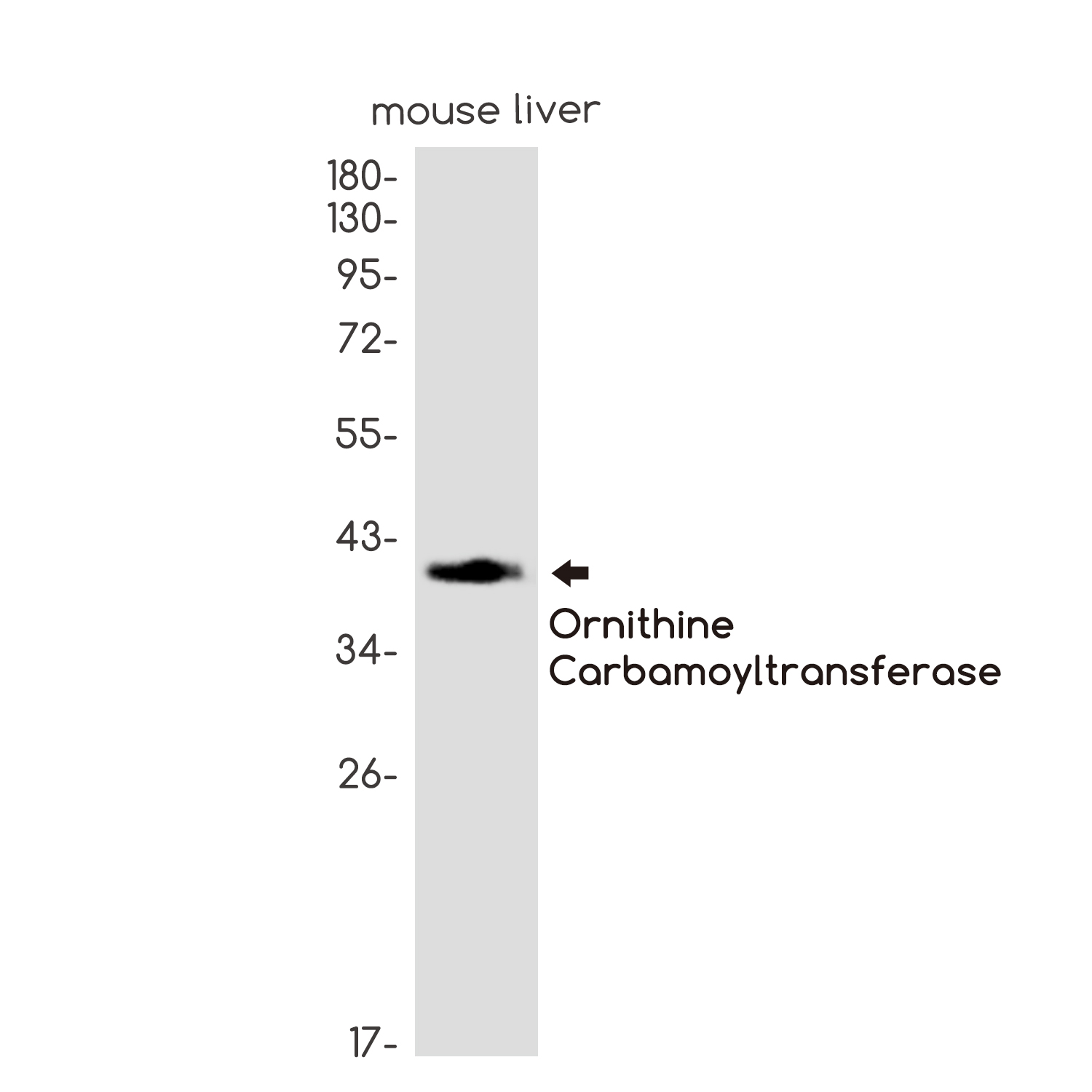 OTC Rabbit mAb ABZ4993