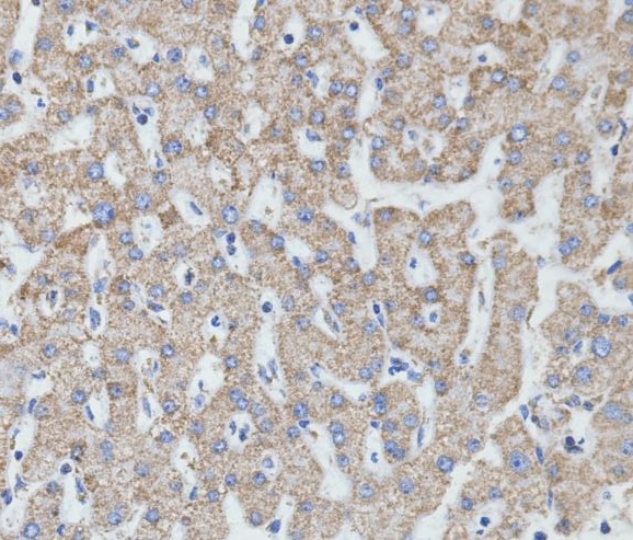 MTCO2 Rabbit mAb ABZ4994
