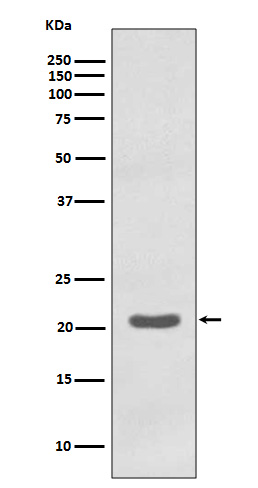 MTCO2 Rabbit mAb ABZ4994
