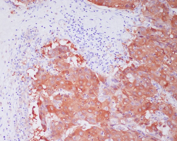 ALDH1A1 Rabbit mAb ABZ4995