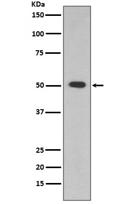 ALDH1A1 Rabbit mAb ABZ4995