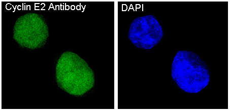 Cyclin E2 Rabbit mAb ABZ4996