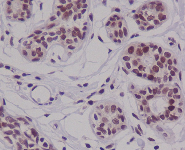 Cyclin E2 Rabbit mAb ABZ4996