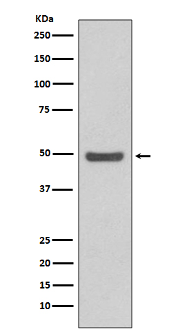 Cyclin E2 Rabbit mAb ABZ4996