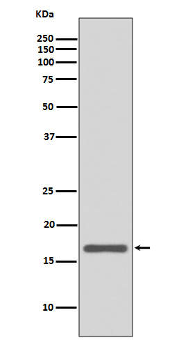 Anterior Gradient 2 Rabbit mAb ABZ4997
