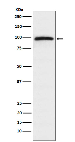 Epac1 Rabbit mAb ABZ4998