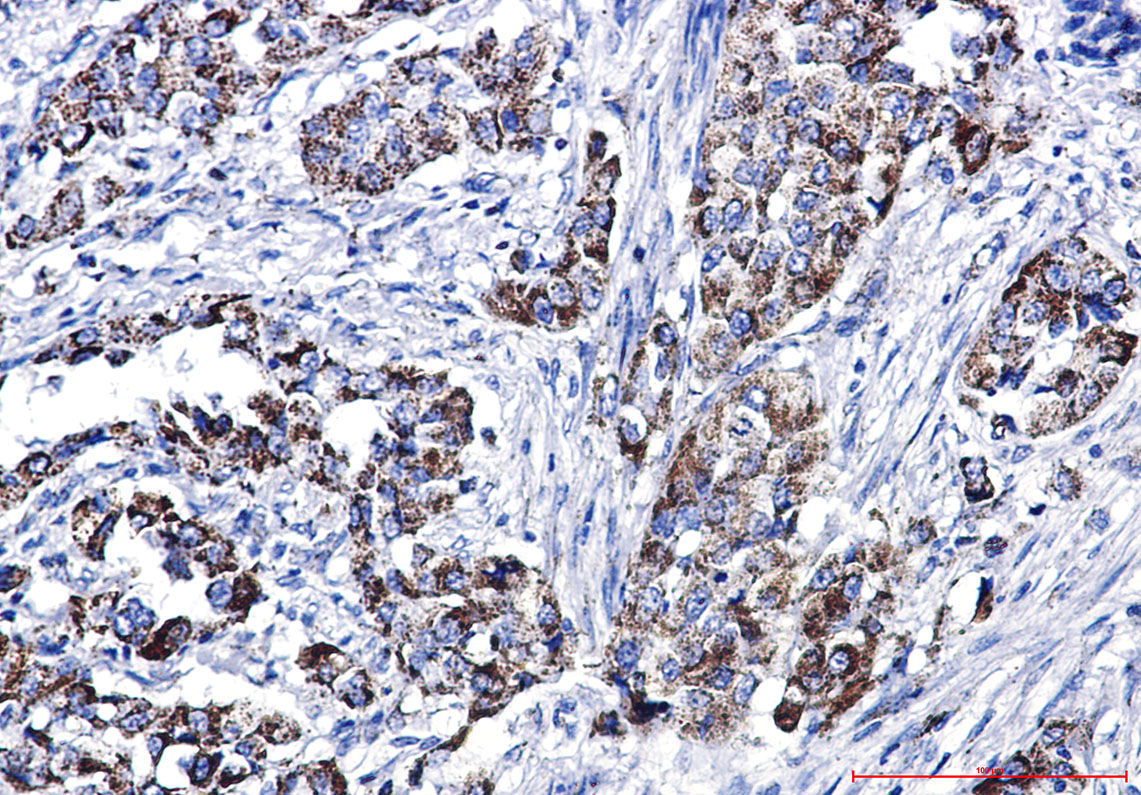 Glutaminase Rabbit mAb ABZ5000