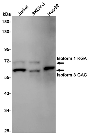 Glutaminase Rabbit mAb ABZ5000