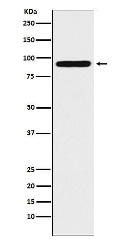 ALDH1L1 Rabbit mAb ABZ5002