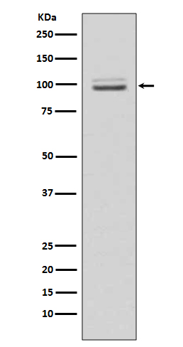 MKLP1 Rabbit mAb ABZ5003
