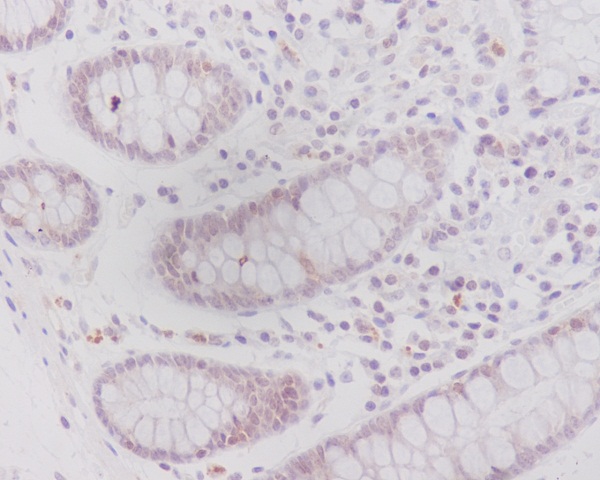 Caveolin-2 Rabbit mAb ABZ5005
