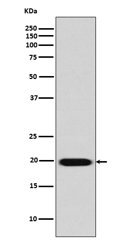 Caveolin-2 Rabbit mAb ABZ5005