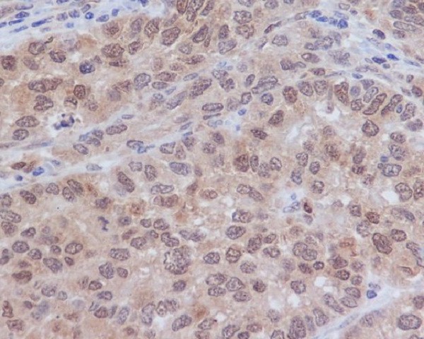 ERK2 Rabbit mAb ABZ5006