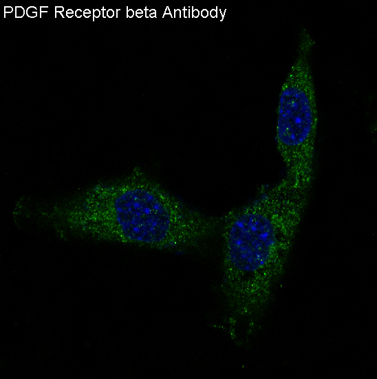 PDGFR beta Rabbit mAb ABZ5007