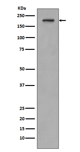 PDGFR beta Rabbit mAb ABZ5007