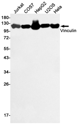 Vinculin Rabbit mAb ABZ5009