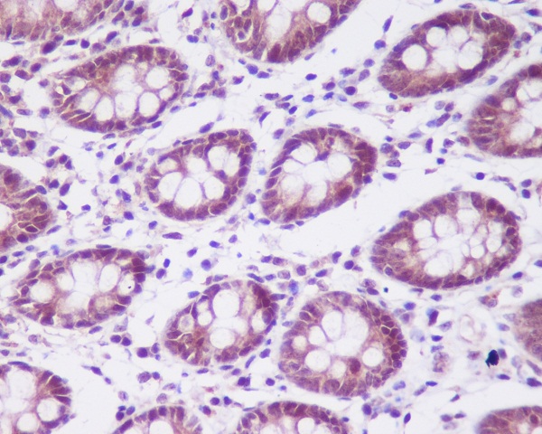 CSNK2A1 alpha Rabbit mAb ABZ5010