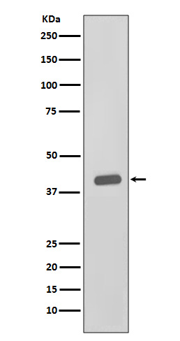 CSNK2A1 alpha Rabbit mAb ABZ5010