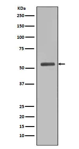 Smad5 Rabbit mAb ABZ5011